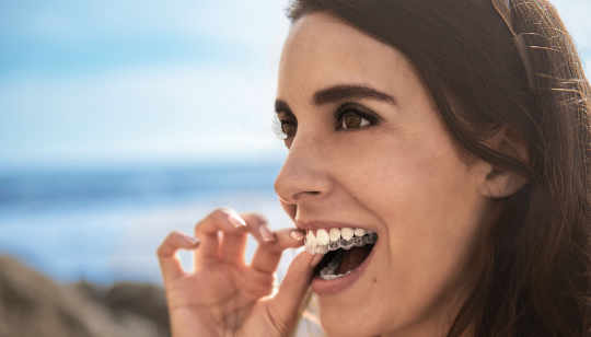 Bild: Aligner Behandlung - Invisalign®-System